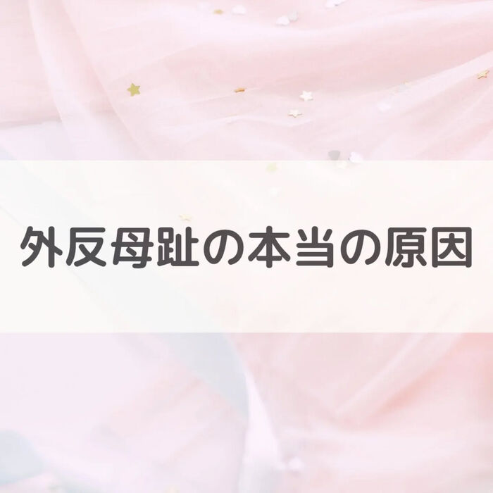 【三郷・八潮】外反母趾の本当の原因｜メルシー整体院